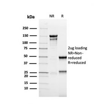 MSH6 Antibody