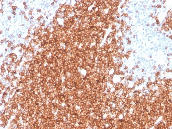 CD22 Antibody / BL-CAM