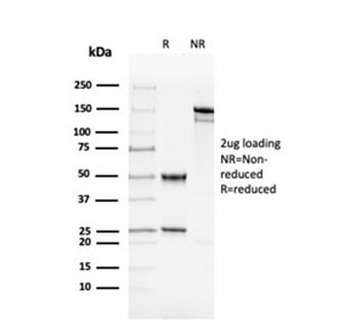 dsDNA Antibody / Double Stranded DNA