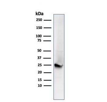 PGP9.5 / UchL1 Antibody