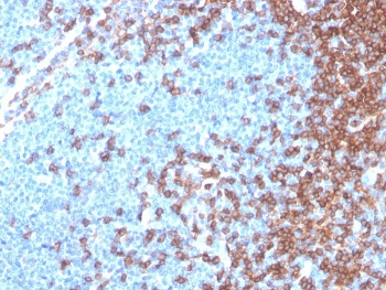 CD4 Antibody