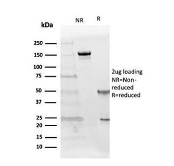 Follistatin Antibody / FST / Activin Binding Protein (FS288 & FS315)
