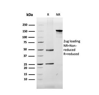 MBP Antibody / Myelin Basic Protein