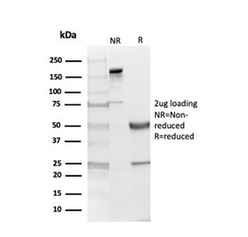 MBP Antibody / Myelin Basic Protein