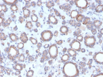DBC2 Antibody / RHOBTB2