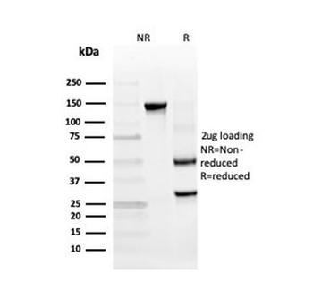 INSM2 Antibody / Insulinoma Associated 2