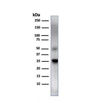 TIM-3 Antibody / HAVCR2