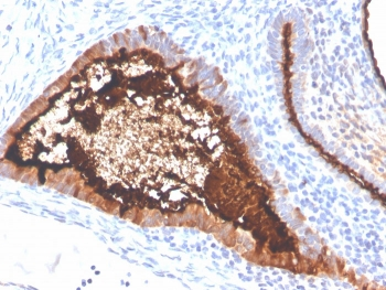 MUC16 Antibody / CA125
