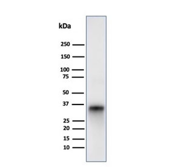 CD74 / CLIP Antibody