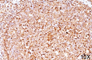 CD79a Antibody