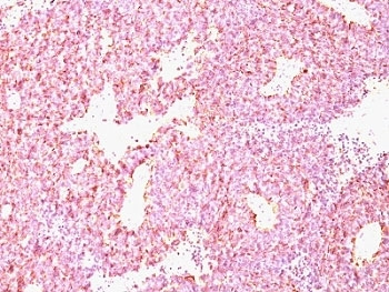 Chromogranin A Antibody