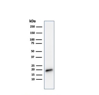 MART-1 / Melan-A Antibody