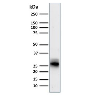 HLA-DRB1 Antibody (MHC II)
