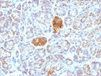 HSP60 Antibody