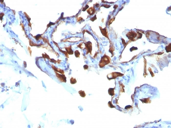 KRT8 Antibody / Cytokeratin 8