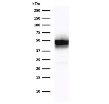 Cytokeratin 18 Antibody
