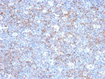 CD146 Antibody / MCAM / MUC18