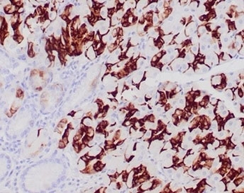 MUC6 Antibody / Gastric Mucin