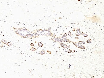 SMMHC Antibody Cocktail (Smooth Muscle Myosin Heavy Chain)