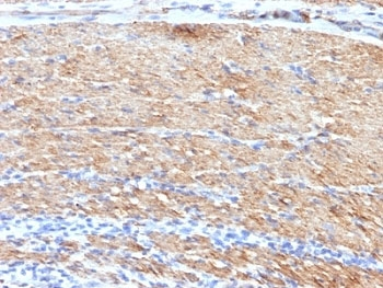 SMMHC Antibody Cocktail (Smooth Muscle Myosin Heavy Chain)