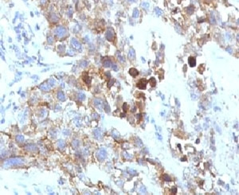 NCAM / CD56 Antibody