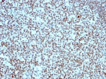 Nucleolin Antibody