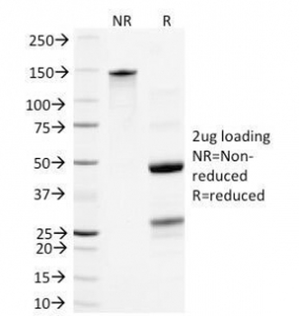 Neurofilament Antibody (-Light) / NF-L / NEFL