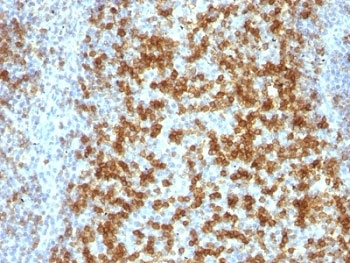 PDCD1 Antibody / PD-1 / PD1