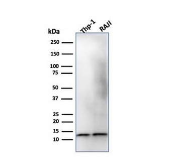 Beta-2 Microglobulin Antibody