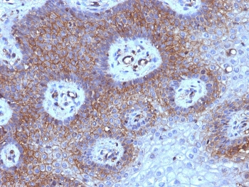 Beta-2 Microglobulin Antibody