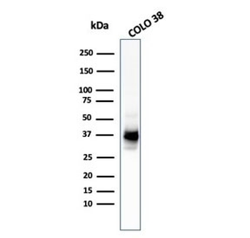PMEL17 / Melanoma gp100 Antibody Cocktail