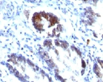 SM22 alpha Antibody / Transgelin