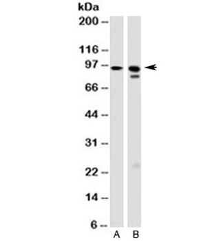 GRP94 Antibody / HSP90B1