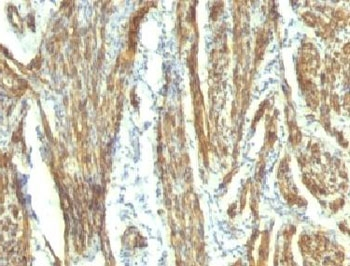 CAD Antibody Cocktail / CALD1 / Caldesmon (HMW)