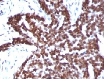 Cyclin B1 Antibody / CCNB1