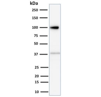 MVP Antibody / Major Vault Protein