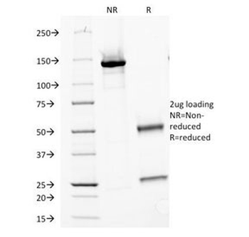 MVP Antibody / Major Vault Protein