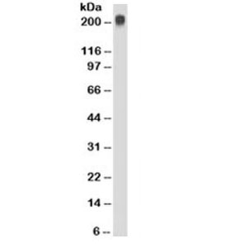 TAG-72 Antibody