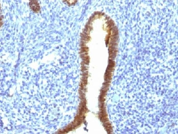 ASRGL1 Antibody / ALP1