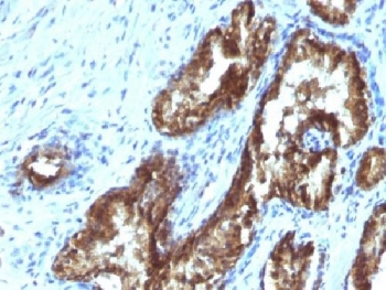 TDP2 Antibody / ETS1 associated protein II