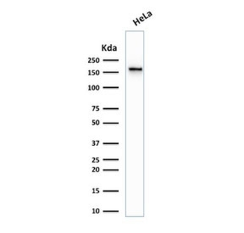 Topoisomerase II alpha Antibody / TOP2A