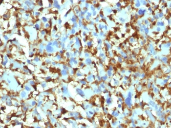 Factor XIIIa Antibody / F13A1