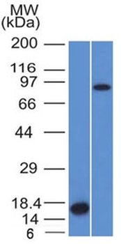 Factor XIIIa Antibody / F13A1