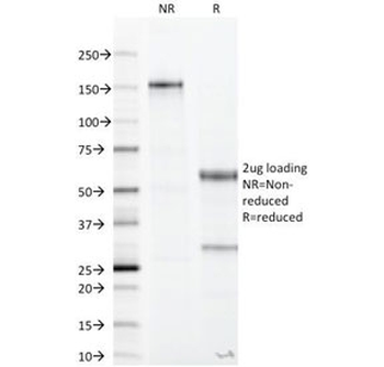 CA19-9 Antibody