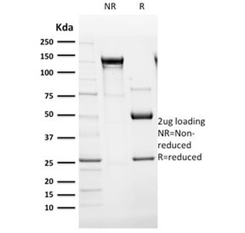 Cytokeratin 14 Antibody / CK14 / KRT14