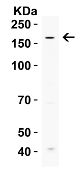 UHRF1BP1 Antibody