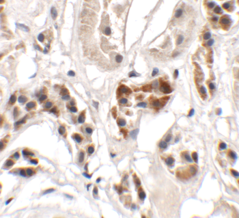 UHRF1BP1 Antibody