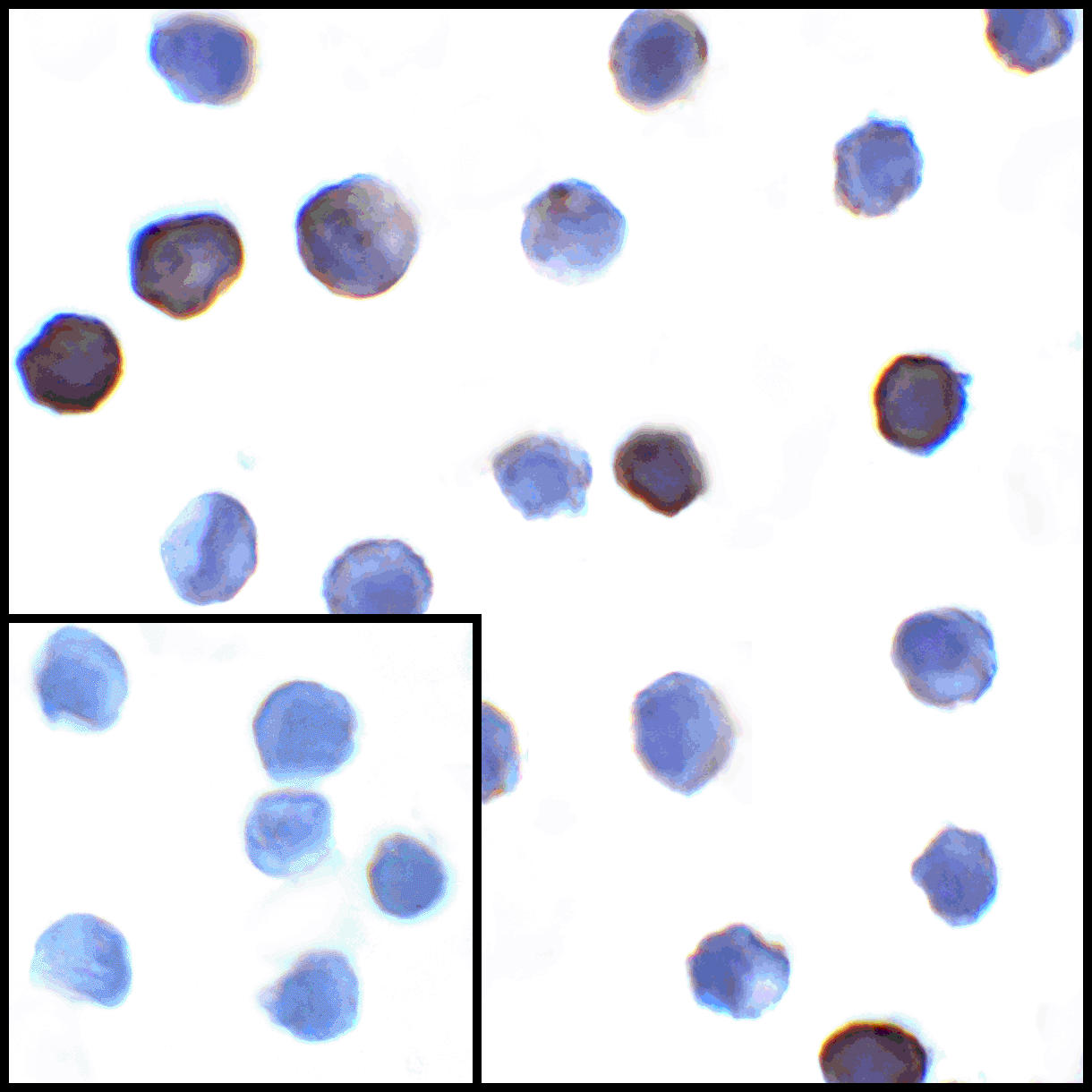 CD274 Antibody