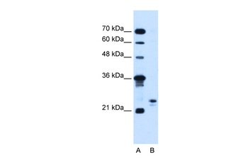 MOSPD3 Antibody