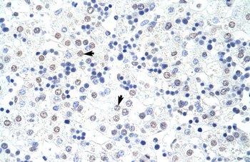 HNRNPL Antibody